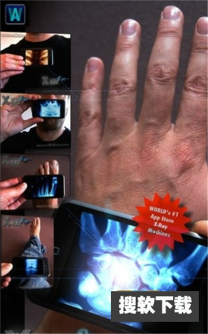 手机骨骼扫描仪软件