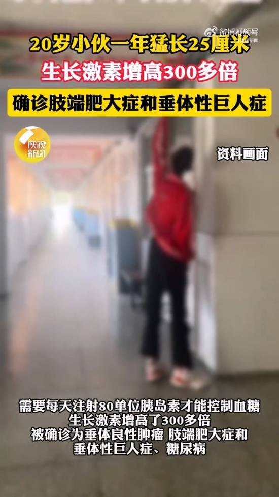 20岁青年一年间身高骤增25厘米，经诊断患上巨人症，目前身高达2米23