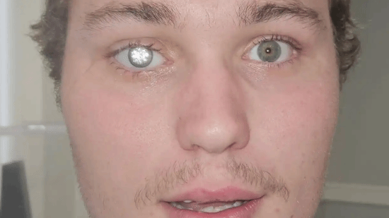 23岁珠宝商打造全球最贵义眼：镶嵌2克拉真钻，价值1425万