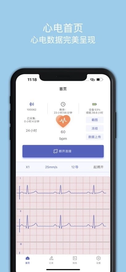 联影小智健康手机版