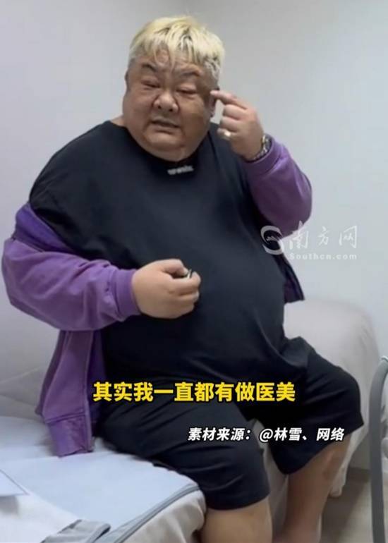 演员林雪亲自透露自己一直在进行医美项目，并回应了粉丝对其健康状况的关切