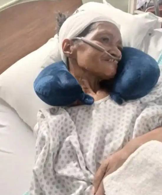 女子手术时一块头骨遗失，医院以25美元礼品卡作为补偿