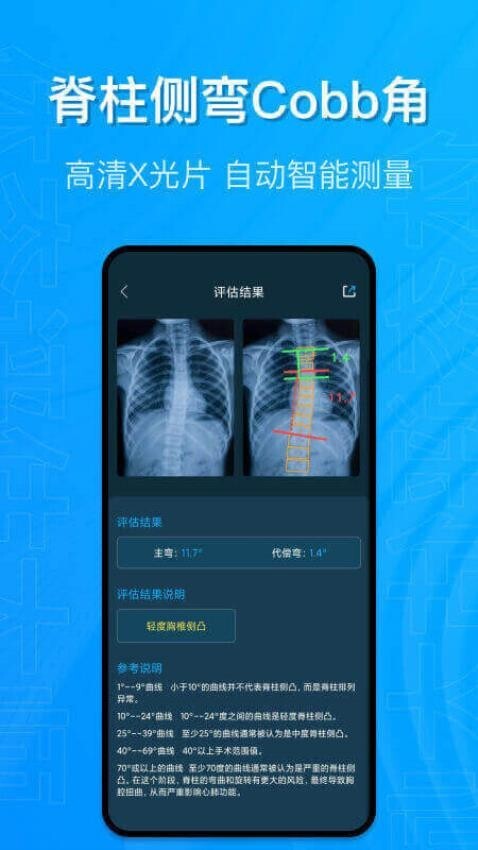 体态评估大师图1