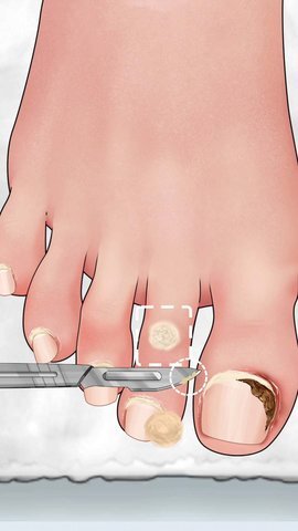 沉浸式修脚大师游戏图2