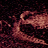 铁肺游戏手机版